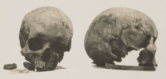 [Skull of John Batman]
